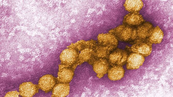 West-Nil-Virus