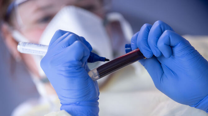 Eine Mitarbeiterin beschriftet eine Blutprobe für einen Antikörpertest.  FOTO: MURAT/DPA