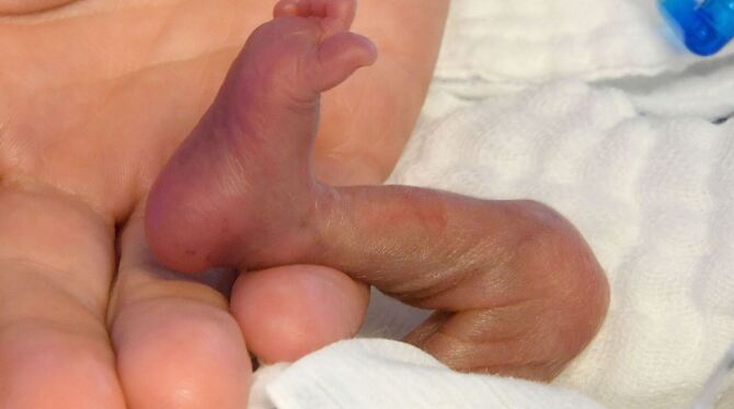 Frühgeborenes braucht Hautkontakt Frühgeborenes braucht Hautkontakt