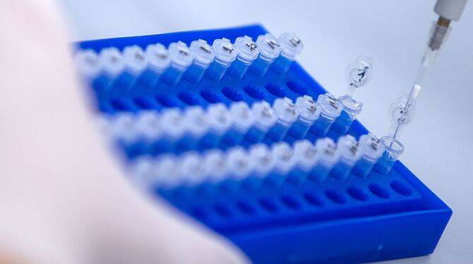 Sequenzierlabor für Corona-Varianten