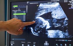 Ultraschall bei Schwangerer