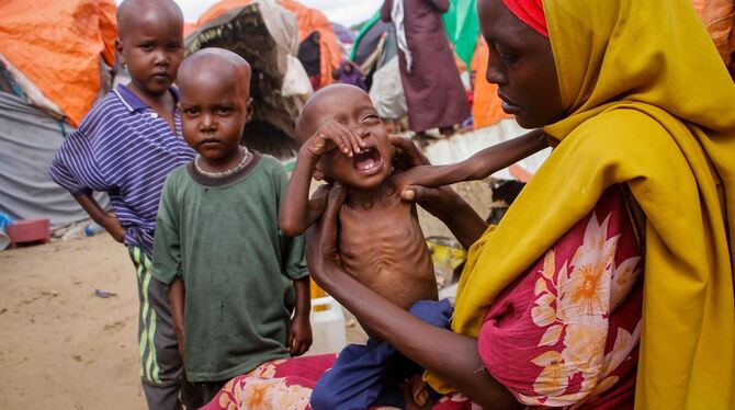 Hunger in Somalia
