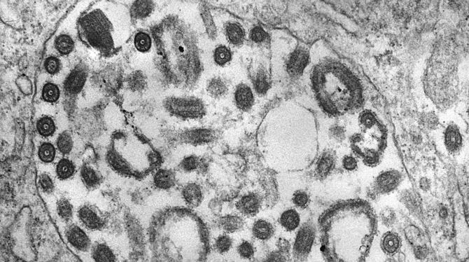 Marburg-Virus Marburg-Virus