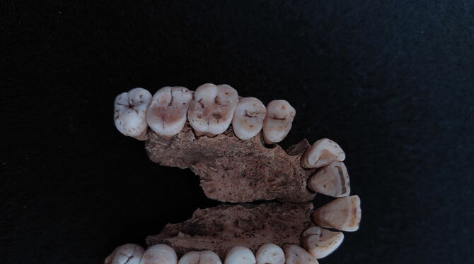 Die spezifische Morphologie der Zähne, wie hier Oberkiefer eines Individuums der Frühbronzezeit von Ammerbuch-Reusten, gestattet
