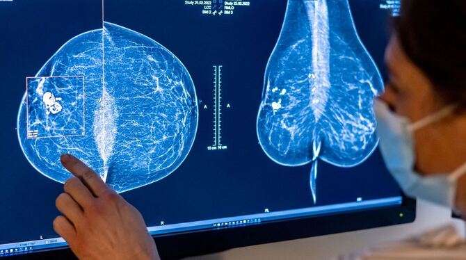 Mammografie