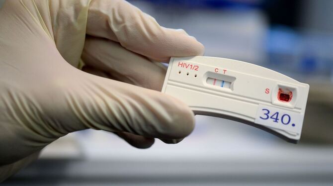 HIV-Schnelltest