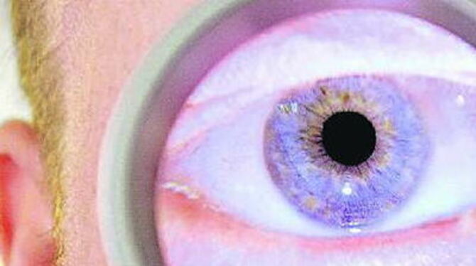 Wenn's anders nicht mehr geht: Leselupe für Sehbehinderte. ARCHIVFOTO: DPA Wenn's anders nicht mehr geht: Leselupe für Sehbehinderte. ARCHIVFOTO: DPA