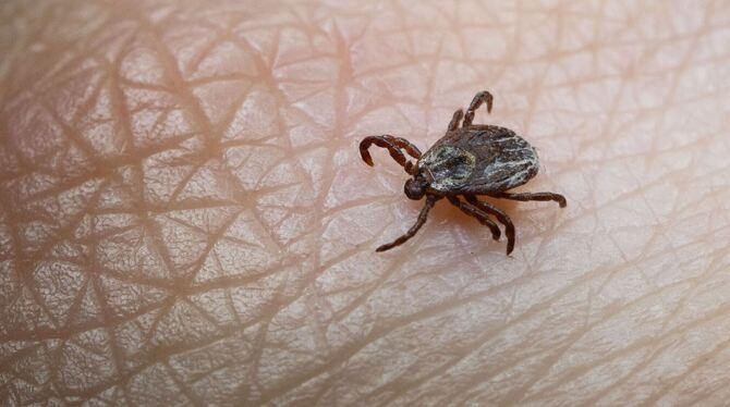 Zecke auf der Haut