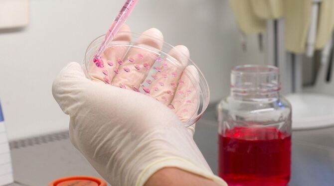 Bei dem von der ZEBET entwickelten embryonalen Stammzelltest prüfen die Wissenschaftler anhand von gezüchteten, embryonalen Stam