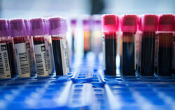 Patienten, die auf die ICI-Antikörper anspringen, leben oft länger.  FOTO: DPA