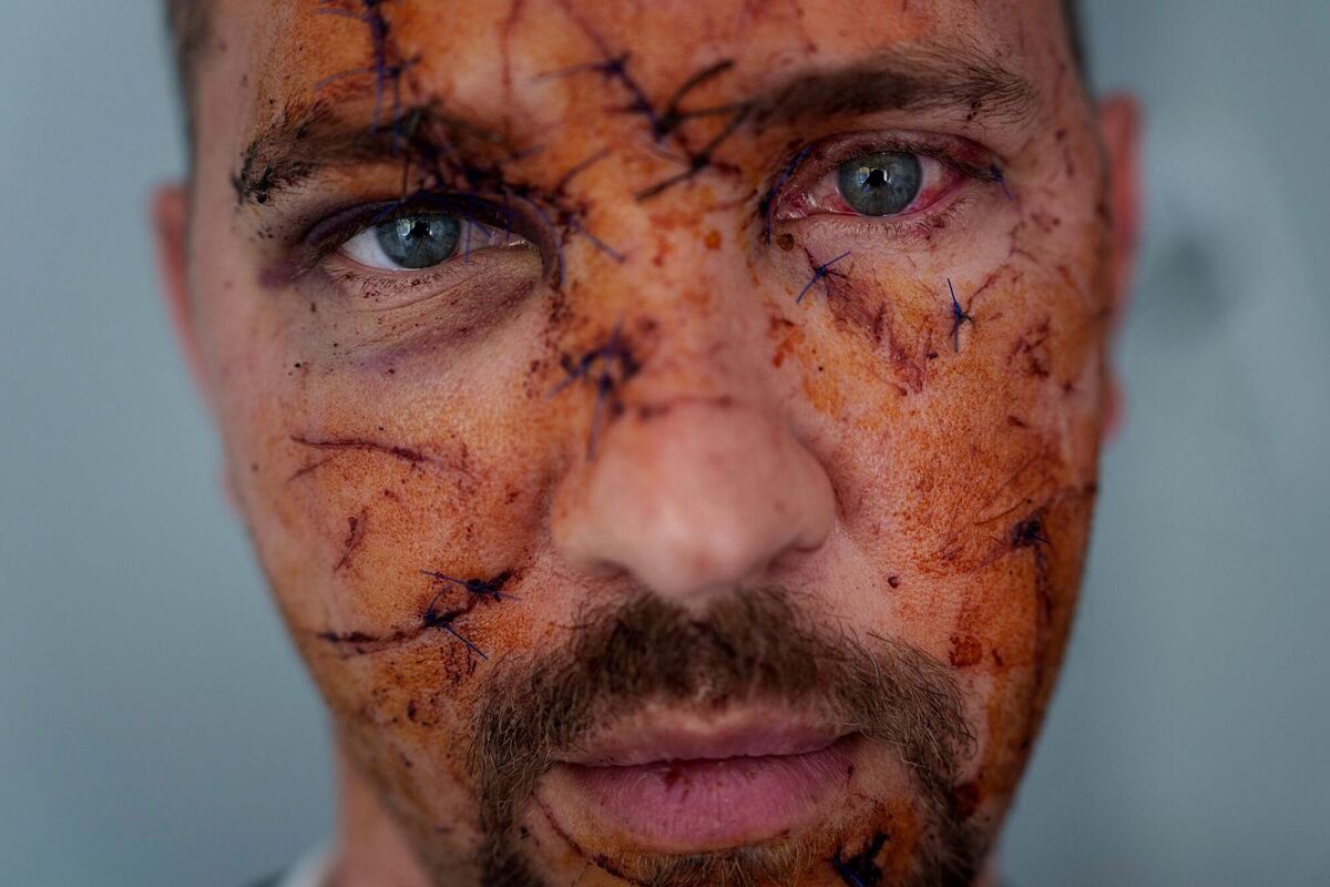 Ukraine-Krieg - Kiew Ukraine-Krieg - Kiew