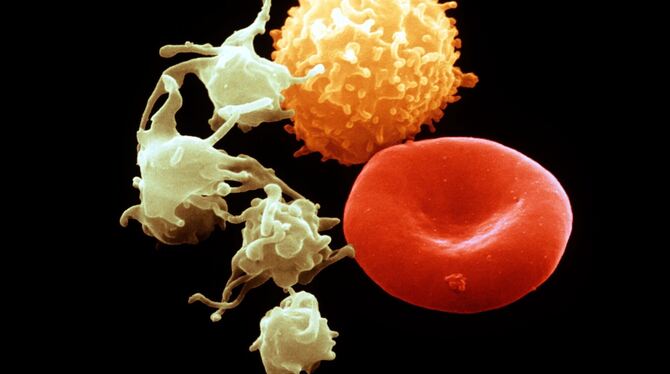 Bei Blutkrebs werden weiße Blutkörperchen gebildet, die durch ihre Masse die gesunden Blutkörperchen verdrängen. FOTO: MAX-PLANC