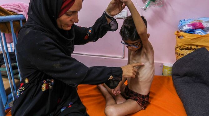 Nahost-Konflikt - Unterernährte palästinensische Kinder Nahost-Konflikt - Unterernährte palästinensische Kinder