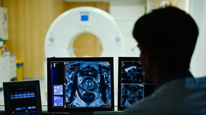 Ultraschall-Bild der Prostata: Die Krebs-Vorsorge wird Männern ab 45 Jahren empfohlen.