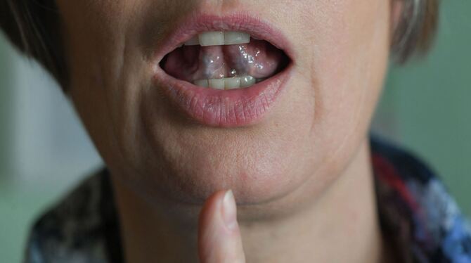 Die wichtigsten Fragen und Antworten zum Welttag des Stotterns Die wichtigsten Fragen und Antworten zum Welttag des Stotterns