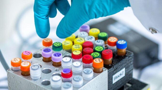 Zwei Menschen an Ehec gestorben Zwei Menschen an Ehec gestorben