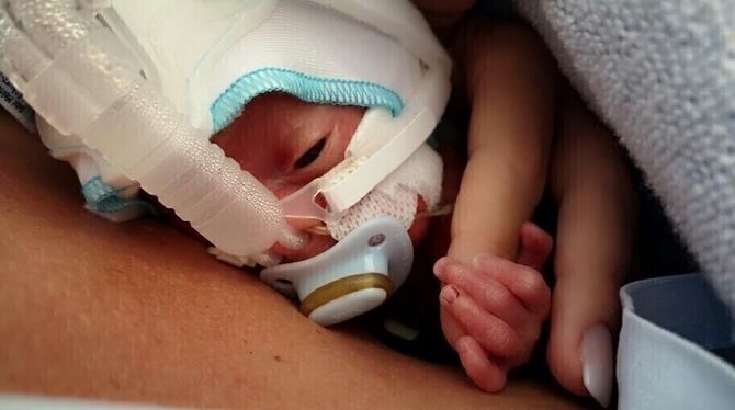 Lauri kam als Frühchen zur Welt.