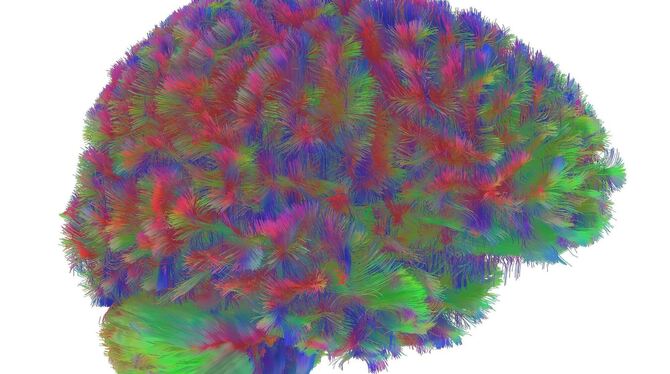 Kindheit bis Alter – Gehirnstruktur durchläuft fünf Phasen Kindheit bis Alter – Gehirnstruktur durchläuft fünf Phasen