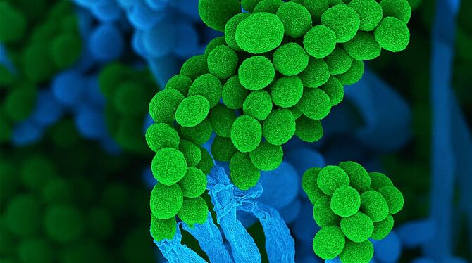 Der Schimmelpilz Penicillium Der Schimmelpilz Penicillium