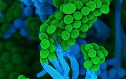 Der Schimmelpilz Penicillium