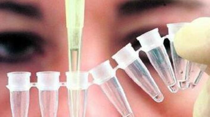 Mit einer Spezialpipette entnimmt eine Gentechnik-Expertin Flüssigkeit aus einem Probenbehälter. FOTO: DPA