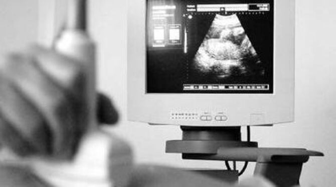 Jede Schwangerschaft, ob geplant oder unverhofft ist eine existenzielle Erfahrung, die mitunter auch Probleme aufwirft. ARCHIVF