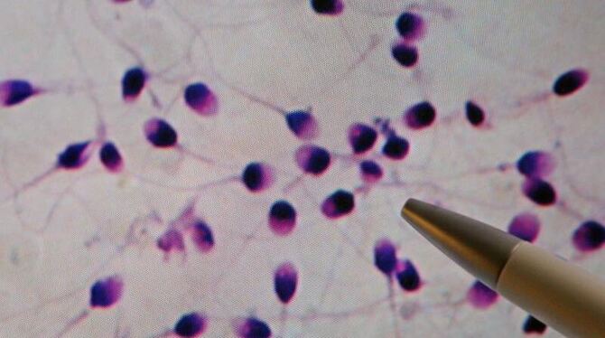 Menschlicher Samen in einem Spermiogramm. Foto: Jan Woitas/Archiv
