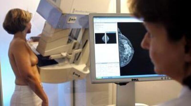 Regelmäßige Mammografien sollen die Früherkennung von Brustkrebs verbessern. FOTO: DPA
