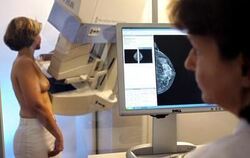 Regelmäßige Mammografien sollen die Früherkennung von Brustkrebs verbessern. FOTO: DPA