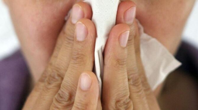 Umfragen deuteten aber darauf hin, dass es verbreiteter sei, trotz Unwohlseins arbeiten zu gehen. Foto: Karl-Josef Hildenbran