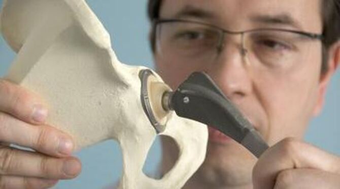 Oberarzt Uwe Ochs präsentiert ein künstliches Hüftgelenk mit Keramikkopf an einem Knochenmodell. FOTO: SCHREIER