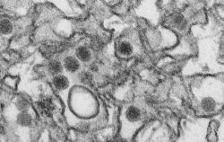 Das gefährliche Zika-Virus unter dem Elektronenmikroskop. Foto: CDC/Cynthia Goldsmith/dpa