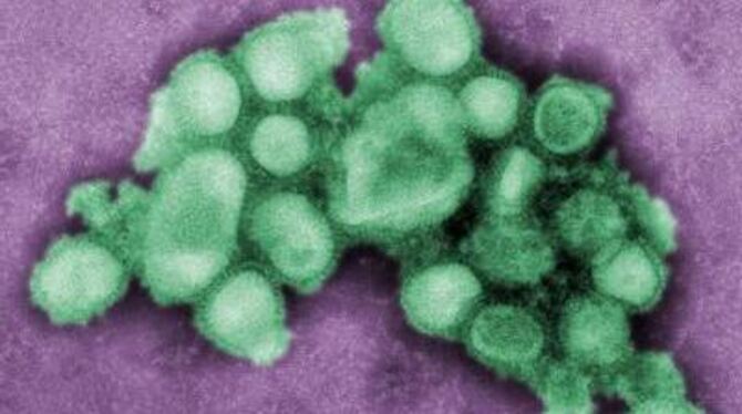 Ein Schweinegrippevirus, aufgenommen von der US-Seuchenkontrollbehörde CDC.
FOTO: DPA