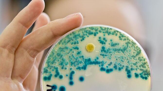 Eine Labormitarbeiterin hält eine Indikatorkulturplatte mit Bakterien in der Hand. (Archivbild)
