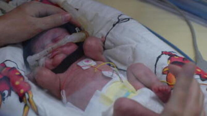 Ein Frühgeborenes im Krankenhaus.