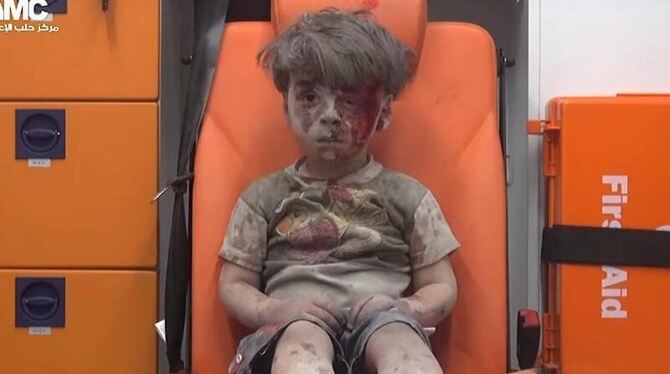 Der fünfjährige Omran war durch Aufnahmen bekannt geworden, die ihn nach einem Luftangriff in einem Rettungswagen zeigen. Fot